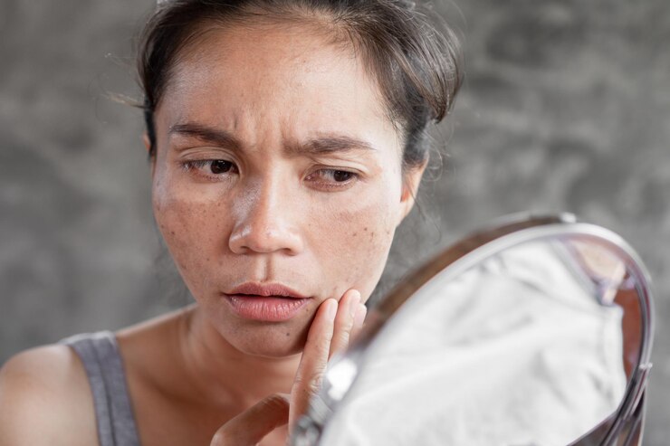 Kulit Lebih Kering dan Keriput? Ini Penyebabnya dan Cara Mengatasinya