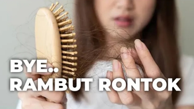 Cegah Kebotakan! Simak Cara Mengatasi Rambut Rontok Dengan Mudah dari Dokter