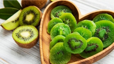 Jarang Diketahui, Ini 5 Manfaat Buah Kiwi, Sehatkan Kulit Hingga Cegah Kanker