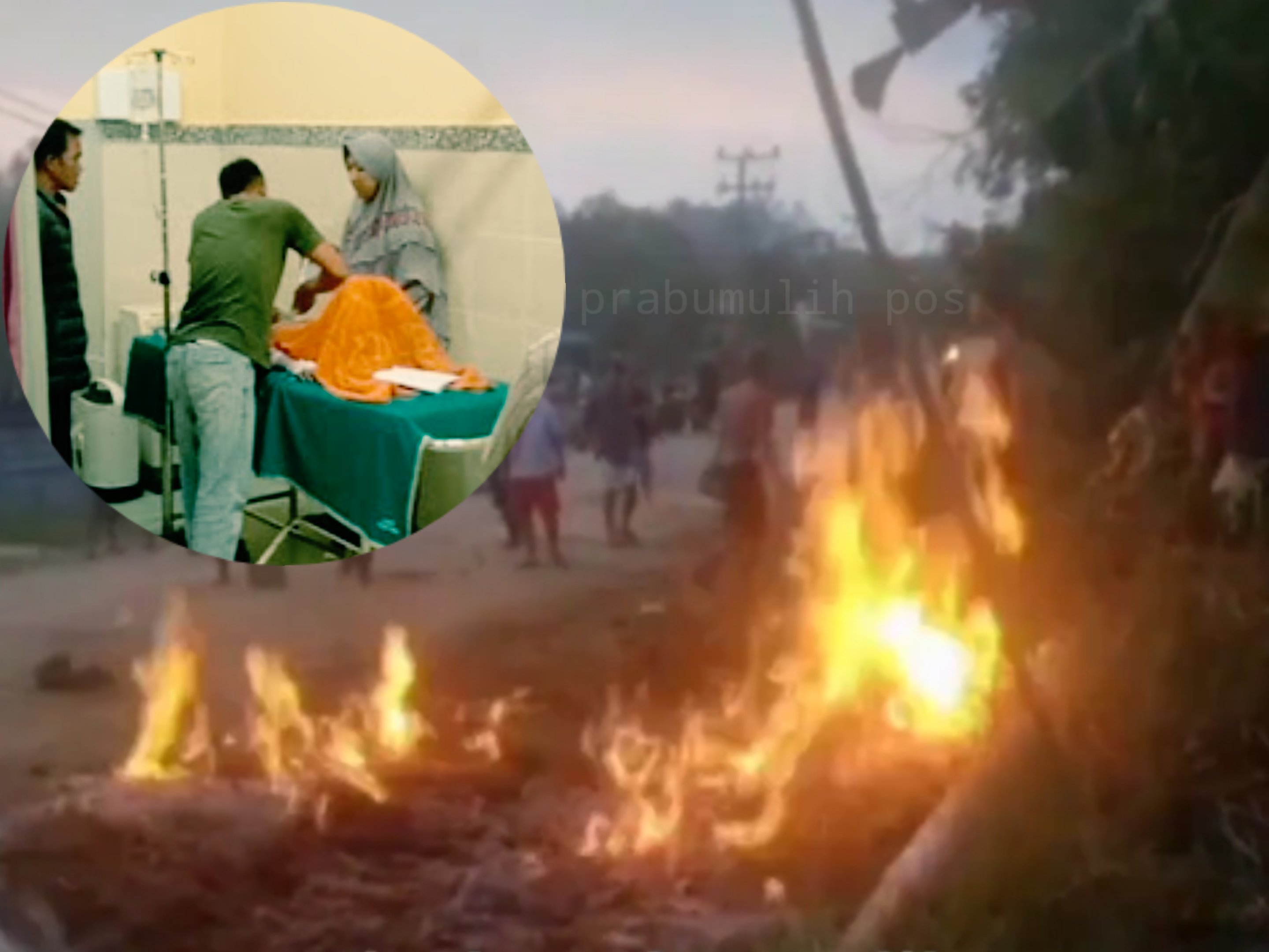 Bermain Korek Api di Lokasi Kebocoran Pipa Gas, Satu Anak di Kota Prabumulih Mengalami Luka Bakar 