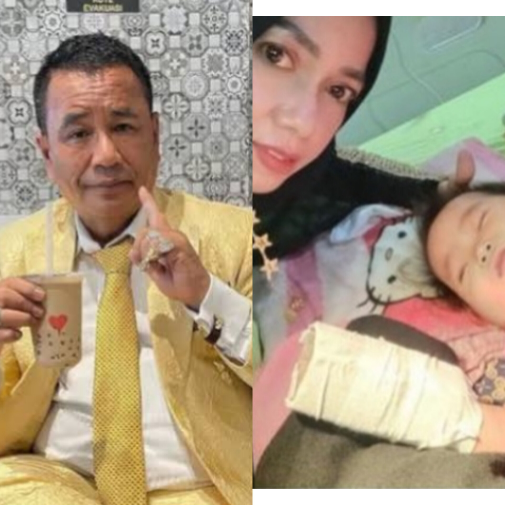 Hotman Paris Siap Temui Keluarga Bayi yang Kelingkingnya Digunting Oknum Perawat di Palembang