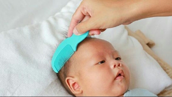 Muncul Kerak Susu di Kepala Bayi? Lakukan 7 Langkah Ini Untuk Atasi Rasa Gatal dan Basmi Dermatitis Seboroik