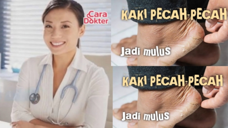 Tips Ampuh Mengatasi Kulit Kaki Pecah-Pecah dari Dokter, Terapkan Mulai Sekarang Yuk!