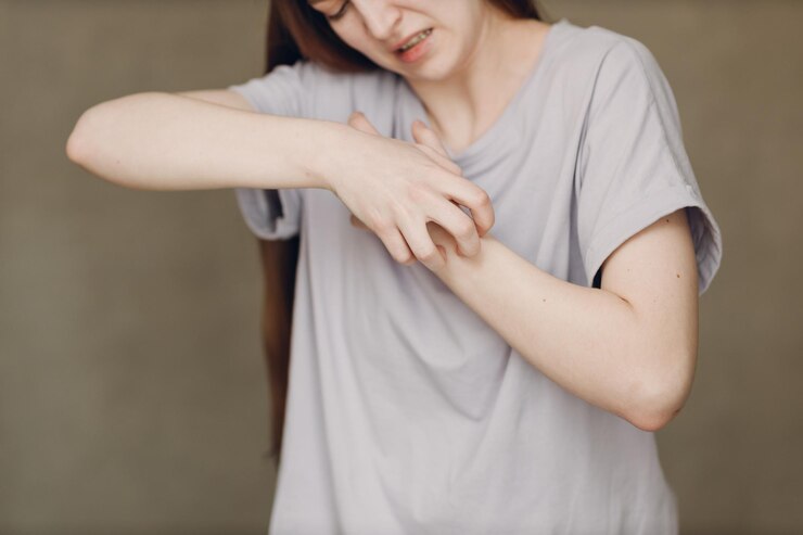 5 Risiko Penyakit Kulit yang Bisa Menular dari Pakaian Thrifting