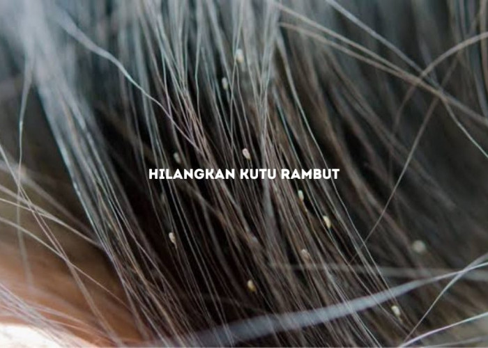 5 Cara Ampuh Hilangkan Kutu Rambut, Dijamin Kutu Langsung Musnah