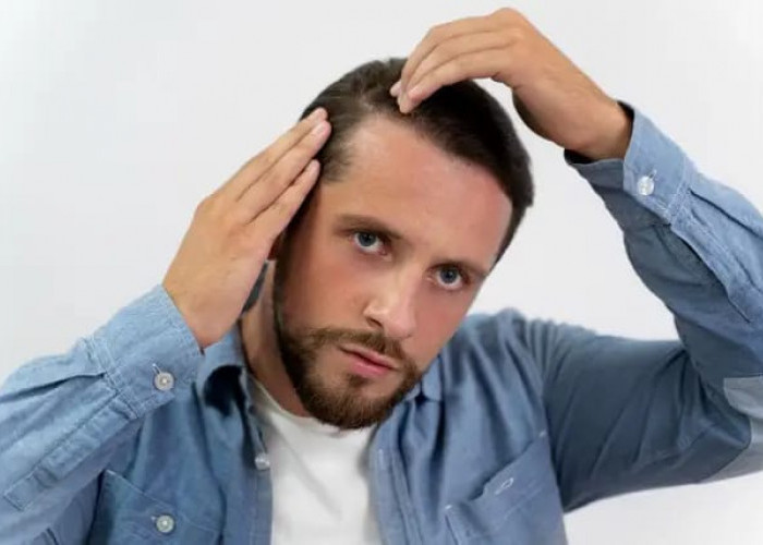 Rambut Rontok pada Pria, Ini Penyebab dan Cara Mengatasinya