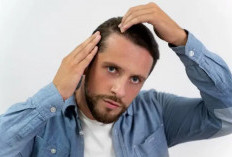Rambut Rontok pada Pria, Ini Penyebab dan Cara Mengatasinya
